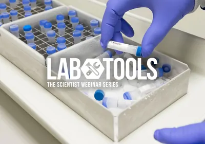 Discover the Freshness of Frozen PBMCs Discover the Freshness of Frozen PBMCs